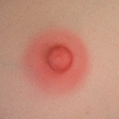 ZELEX-Nipple-color (1)